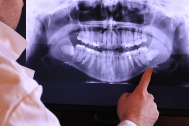 Best Emergency Dental Care for Broken or Chipped Teeth in Morrisonville, NY